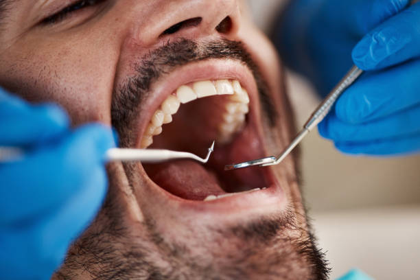 Best Urgent Tooth Repair  in Brookwood, AL